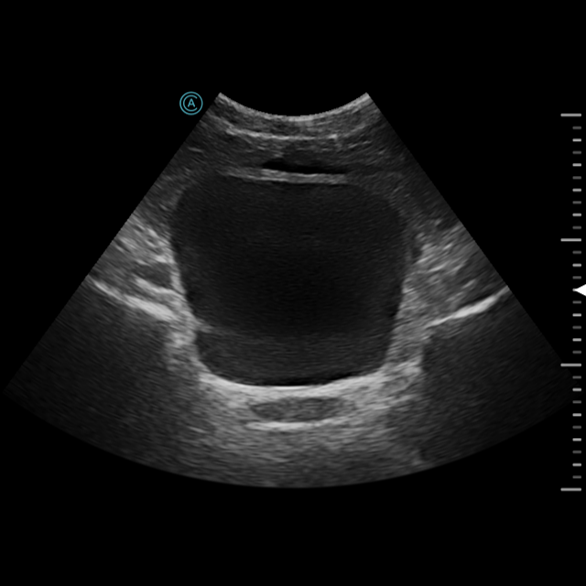 The neo C62 easily visualizes the bladder during a routine exam