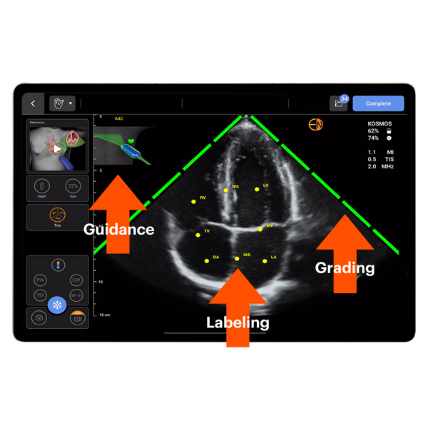 EchoNous Kosmos Ultraportable Ultrasound