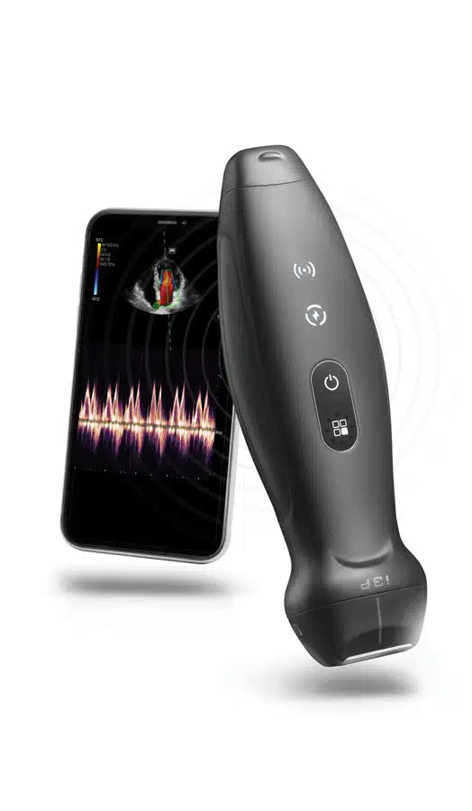 Mindray TE Air Handheld Ultrasound